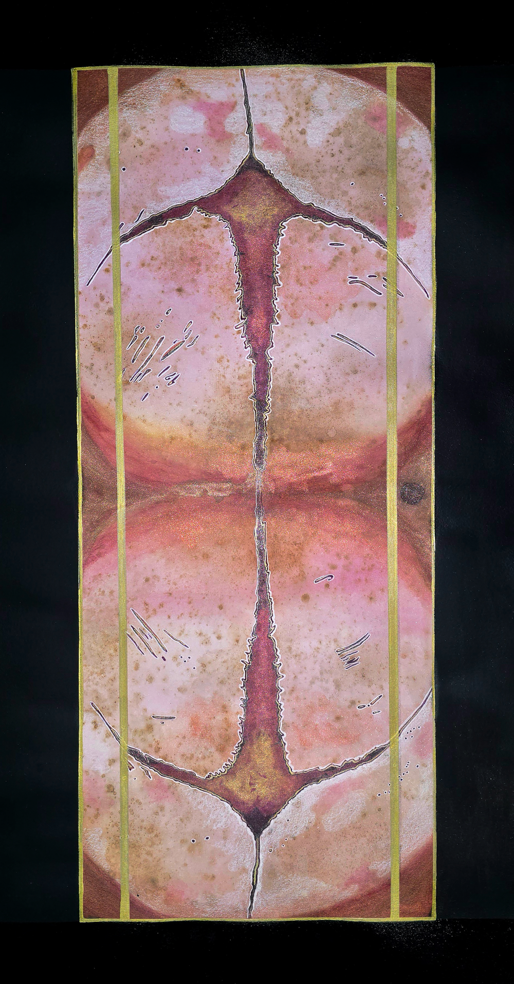 Sagittal Suture II: Age of Innocence